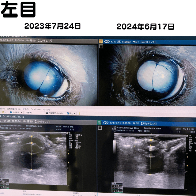 進行性網膜萎縮20240617